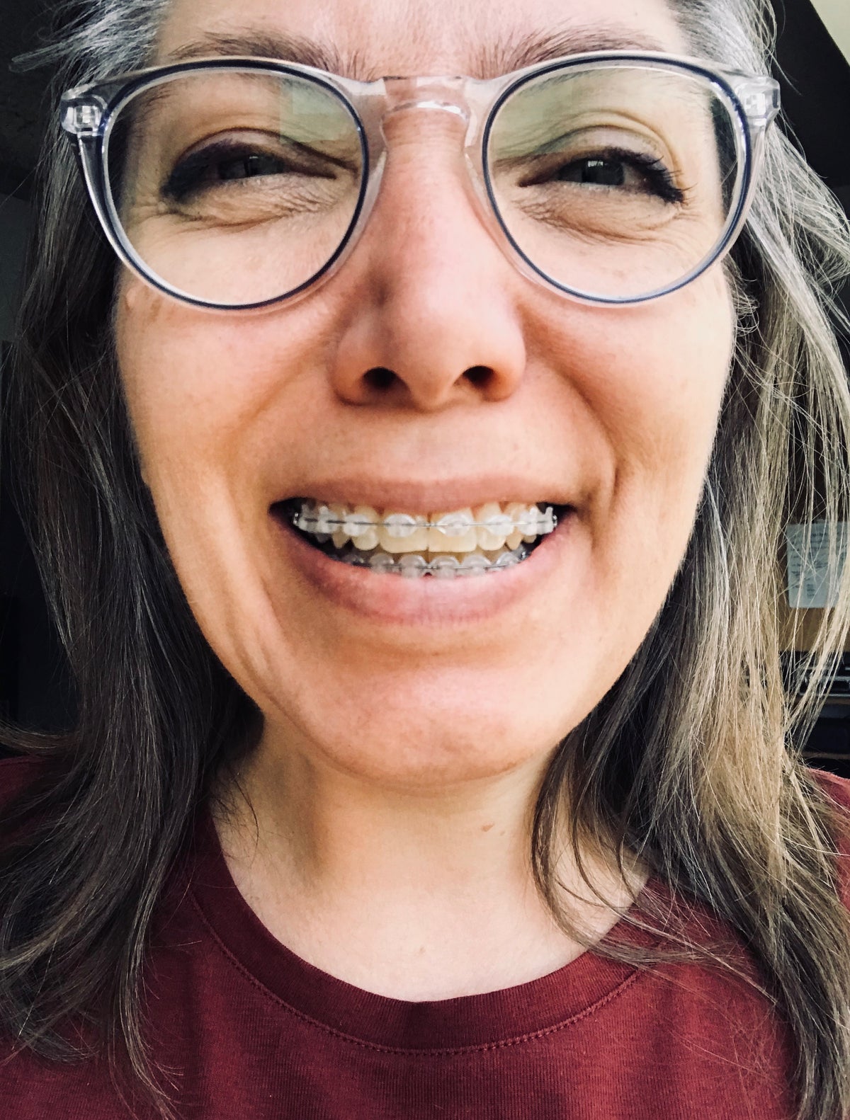 10 months in mltshp